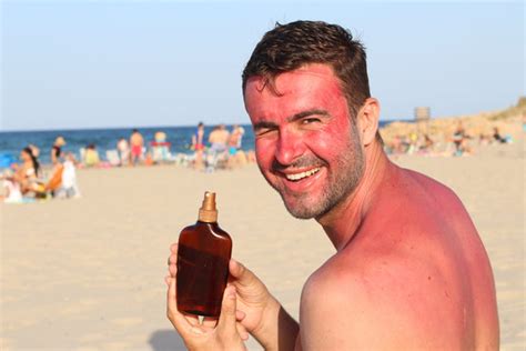 05 2023 how to turn a sunburn into a tan fast