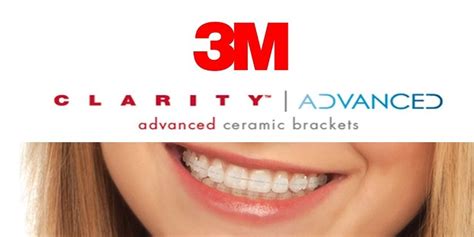 3m Clarity Advanced Bracket Set Single Arch Ias Shop