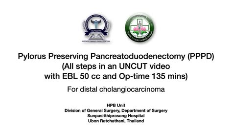 Pylorus Preserving Pancreatoduodenectomy Pppd All Steps In An Uncut