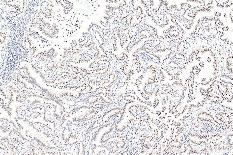 Pold2 Antibody 29765 1 Ap Proteintech