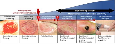 Ozone As A Topical Treatment For Infected Dermal Wounds