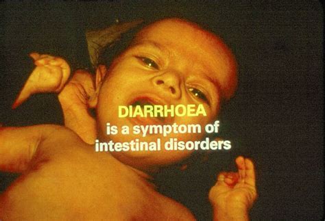 Slide 22 A Simple Solution To Curb The Effects Of Diarrhoea In