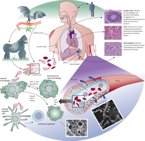 Pathogenesis Of The Ebola Virus Robotspacebrain