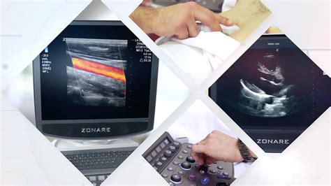 Point Of Care Ultrasound Changing Practice For The Better In Nicu