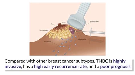 Metastatic Triple Negative Breast Cancer
