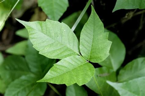 Poison Ivy Rash Signs Symptoms Treatment And Prevention