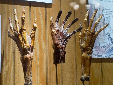 The 12 Creepiest Exhibits At Philadelphias Mütter Museum Of Medical