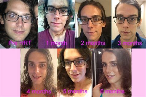 Transgender Transitions Transgender Transition Timelines Know Your Meme
