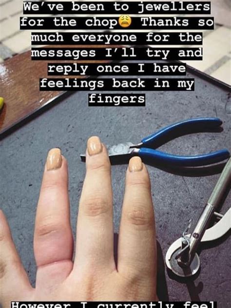 woman has 898k engagement ring cut off her swollen finger daily telegraph