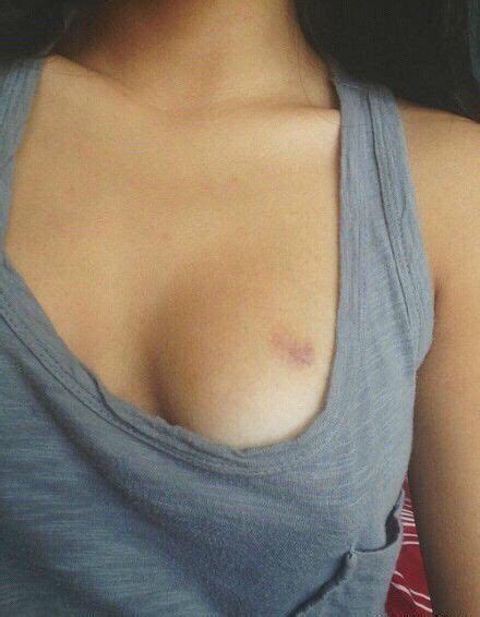 Boob Hickey Pictures Excellent Porn Comments