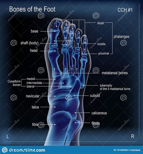 Osteoporosis, a condition in which the bones become weak and brittle, is detectable on an. X ray of bones the of foot stock vector. Illustration of ...
