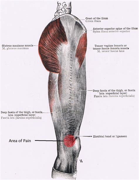 Anatomy Of The Sinew Channels Iliotibial Band Friction Syndrome A