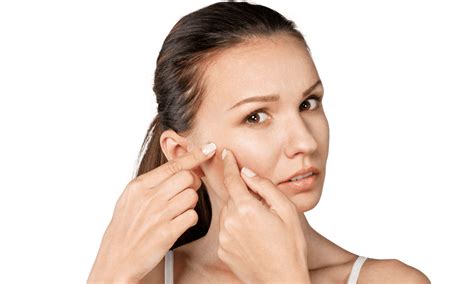 Blind Pimple Causes Prevention And Treatment Tips Glowastica