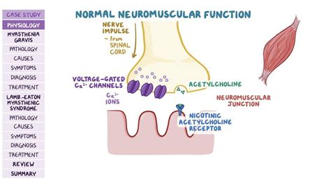 Neuromuscular Junction Disorders Pathology Review Osmosis
