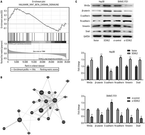 Sex Comb On Midleg Like Accelerates Hepatocellular Carcinoma Cell Proliferation And Metastasis