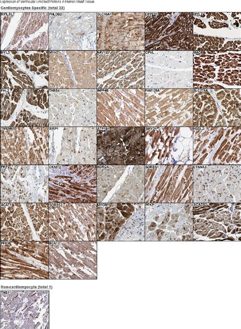 History of the human protein atlas. Proteine Atlas Rat : The Allen Brain Atlas Toward ...