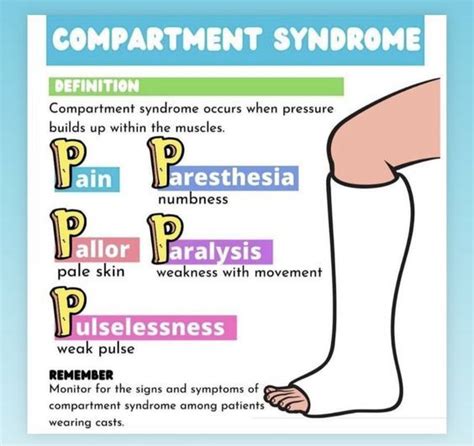 Compartment Syndrome Mnemonic Nursingschool Nursingresources Image