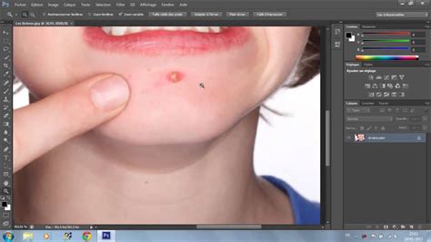 Très souvent, ces petits boutons blancs présents presque exclusivement sur le visage du poupon apparaissent dans ses premiers mois de vie. PhotoShop - Enlever les boutons sur le visage - YouTube