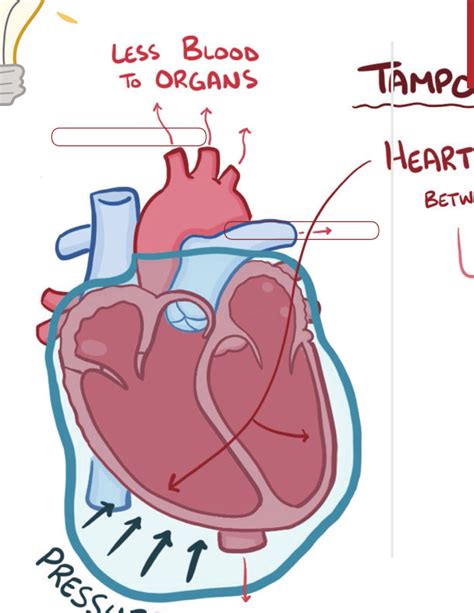 Pericardial Disease Notes Diagrams And Illustrations Osmosis