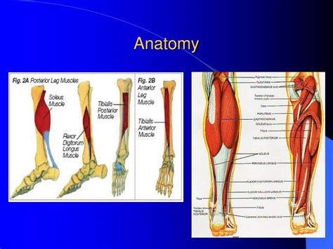 Ppt Medial Tibial Stress Syndrome A Case Study Powerpoint