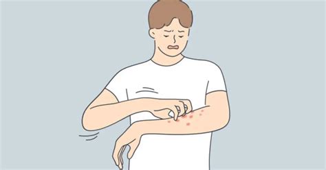 Stress Rashes And Hives What You Should Know The Health Rank