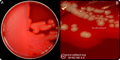 Fusobacterium Necrophorum Subsp Necrophorum