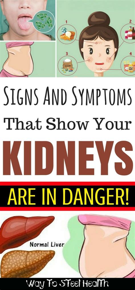 The kidneys are located at the rear wall of the abdominal cavity just above the waistline and are protected by the ribcage. The following vital organs have a location right under the rib cage (With images) | Kidney detox ...