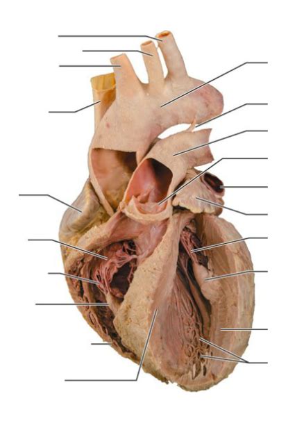 Interior Anatomy Of The Human Heart Cadaver Diagram Quizlet