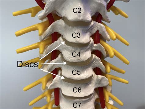 Cervical Disc Replacement — Matthew Mian Md