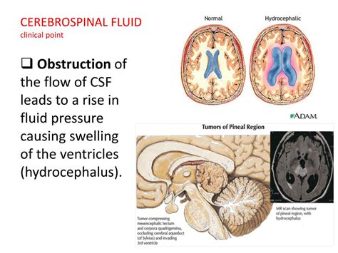 Ppt Meninges Ventricles And Csf Powerpoint Presentation Free Download