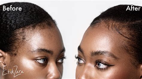 How To Slay 4c Baby Hair Edges That Wont Lay Easy Long Lasting 👩