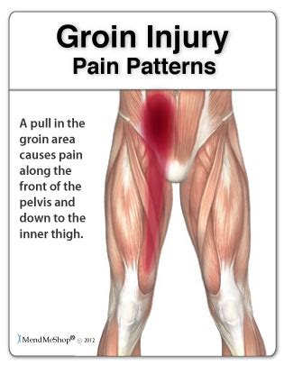 The area that is often used for inflicting pain to males in wrestling matches; What Does a Pulled Groin Feel Like? Full List of Symptoms ...