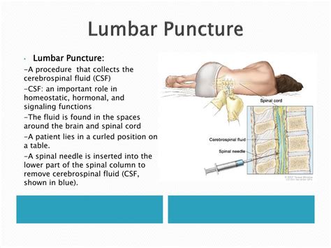 Ppt Spinal Cord Extraction And Tissue Embedding For