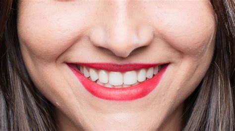 Consejos Para Tener Una Sonrisa Bonita Clínica Dental Miguel Noguer