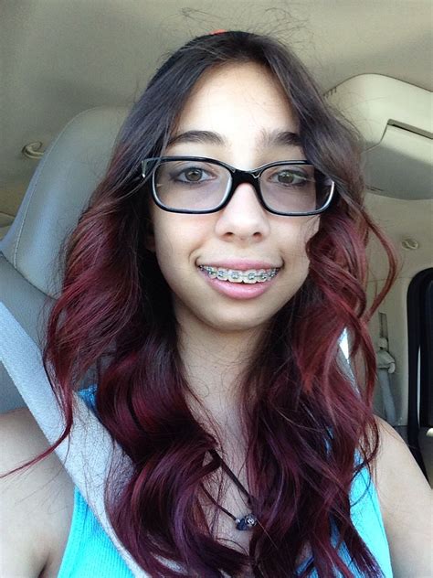 Pin By Kelly Spragg On Braces Braces And Glasses Cute Girls With