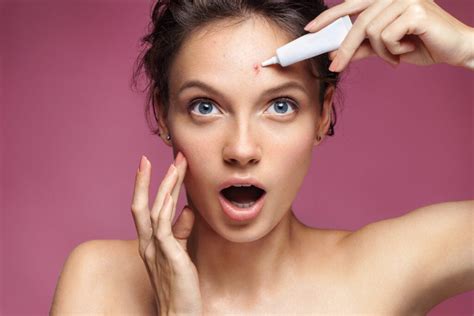 6 Different Types Of Acne Scars And How To Treat Them Dermaflage