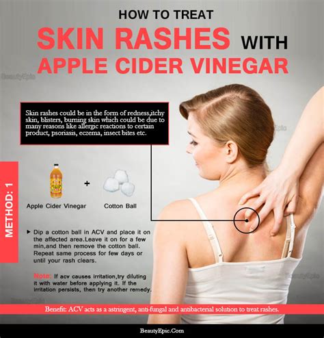 Fortunately, many natural and home remedies can help provide relief. How to Use Apple Cider Vinegar for Skin Rash?