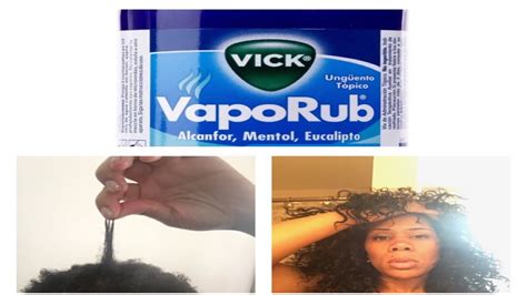The Truth About Using Vicks Vapor Rub For Hair Growth Youtube