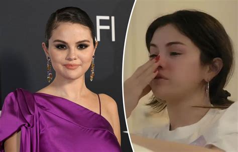 What Is Lupus Selena Gomez Breaks Down Over Her Diseases In Her New
