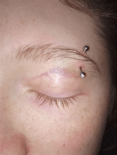 Just Got My Second Eyebrow Piercing 3 Days Ago And Is It Normal For