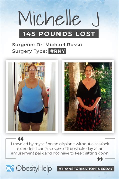 Before And After Rny With Michelle J Down 145 Lbs Obesityhelp