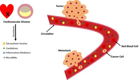 Reverse Cardio‐oncology Cancer Development In Patients With