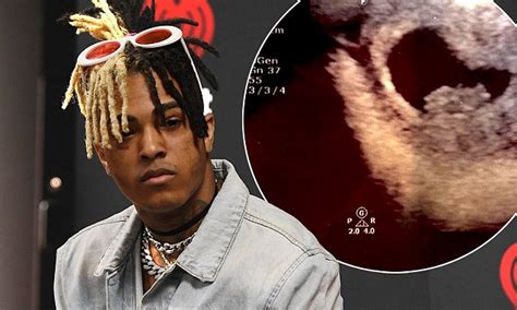 Xxxtentacion Knew For Weeks That His Girlfriend Was Pregnant Daily Mail Online