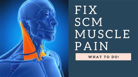 Fix Sternocleidomastoid Scm Muscle Neck Pain Headaches And Jaw Pain