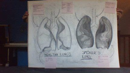 Smokers Lungs Diagram My Xxx Hot Girl