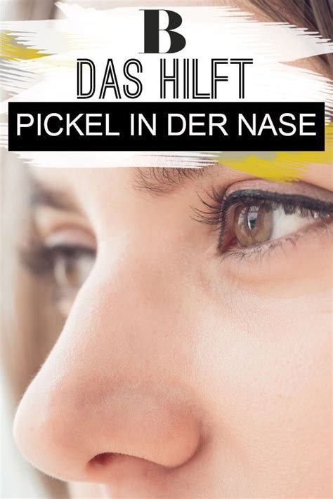 We did not find results for: Pickel in der Nase: So werdet ihr sie los | Pickel auf der ...