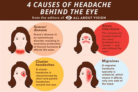 Health And Meditation Headache Behind The Eye Why It Happens What Helps