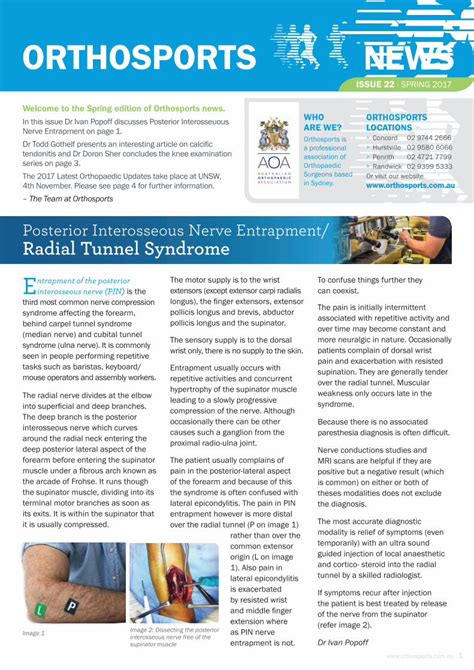 Pdf Posterior Interosseous Nerve Entrapment Radial Tunnel Syndrome Affecting The