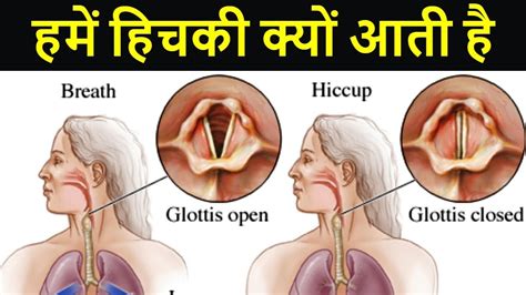 Once is funny, twice is hilarious, and anything more than that is usually just annoying. हमें हिचकी क्यों आती है | Why do We Get Hiccup | Science ...