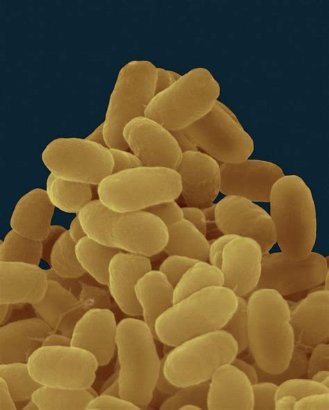 Bordetella Pertussis Photograph By Dennis Kunkel Microscopyscience